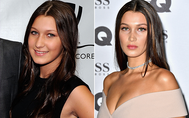 bella-hadid-antes-depois