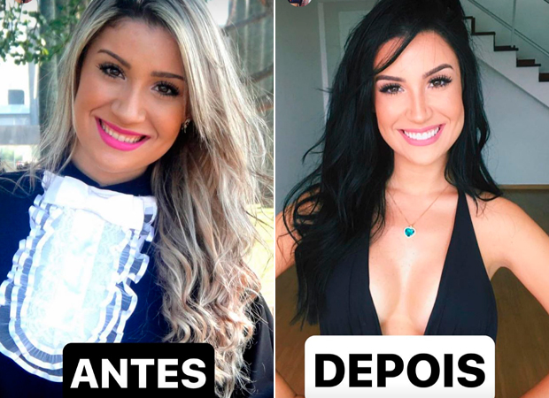 bianca andrade dentes antes depois