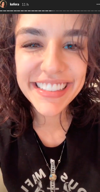 kefera-lente-de-contato-dente-2 kefera-lente-de-contato-dente-2
