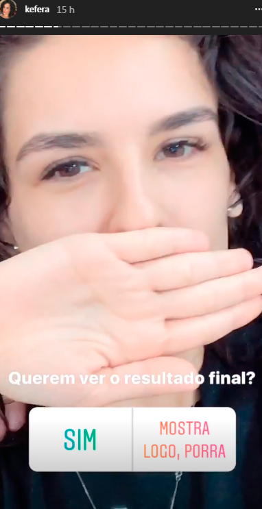 kefera-lente-de-contato-dente kefera-lente-de-contato-dente