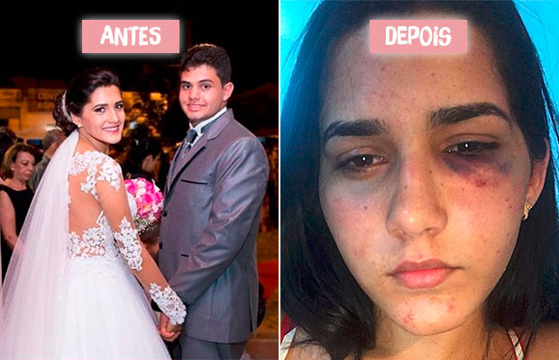 #TodosPorClara: jovem cria Instagram para apoiar amiga agredida por ex