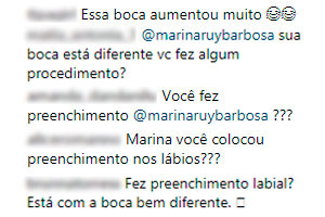 marina-ruy-barbosa-fas-questionam-preenchimento-labios