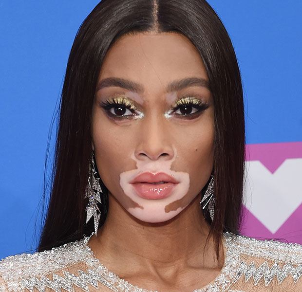 vma-2018-make-cabelo-famosas-Winnie-Harlow