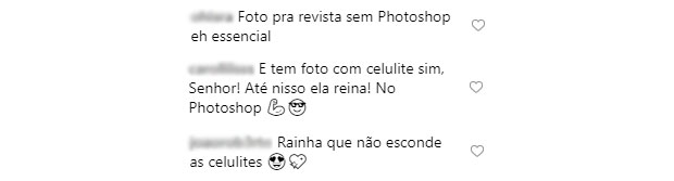 fas-exaltam-celulite-anitta fas-exaltam-celulite-anitta