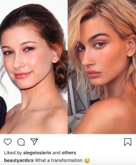 hailey-bieber-antes-depois