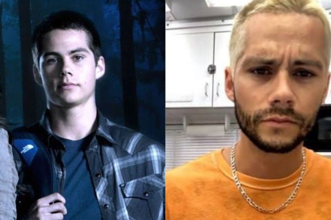 dylan-obrien Duas fotos do ator Dylan O'Brien. Em uma, ele aparece mais novo vestindo uma blusa xadrez e de mochila. Na outra, está posando com uma blusa laranja e mais velho