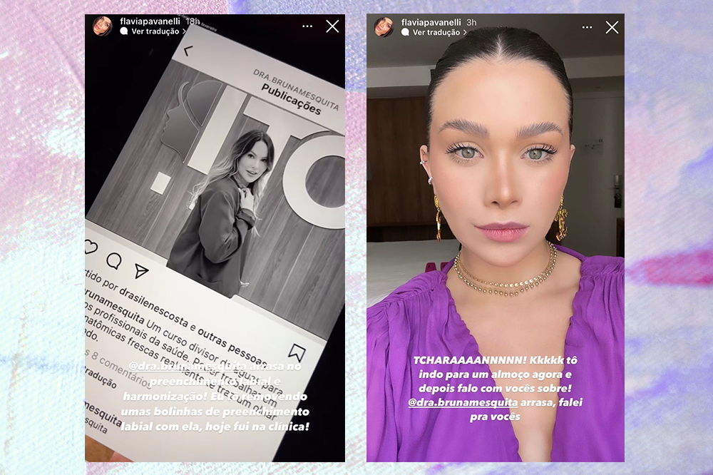flavia-pavanelli-preenchimento-labial Montagem em fundo lilás com duas capturas de tela do Instagram da Flavia Pavanelli. À esquerda, ela mostra o perfil de sua dentista que removeu seu preenchimento labial, à direita ela mostra o resultado do procedimento em uma selfie.