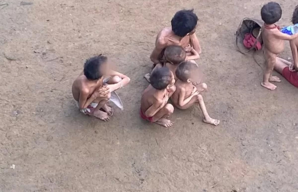 Entenda os pontos-chave da crise humanitária que afeta o povo Yanomami Crianças yanomamis desnutridas