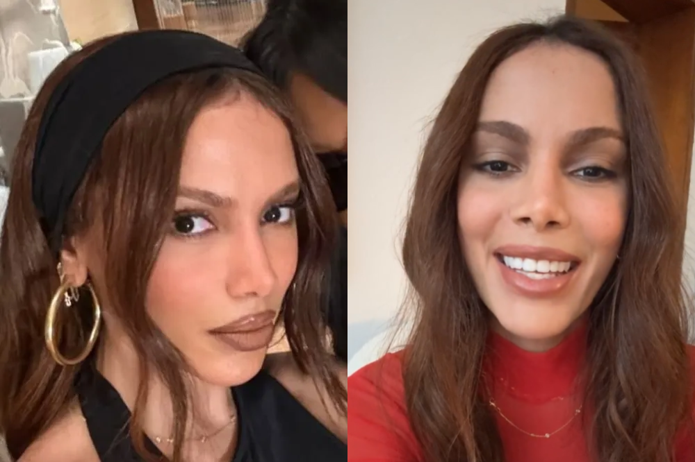 Montagem mostra novo rosto de Anitta em dois momentos diferentes